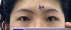 -天津健丽·去眼袋医疗美容机构