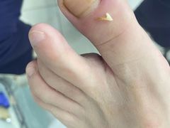 -世龙世家灰指甲·甲沟炎·跖疣护理·修脚(东江湾路店)