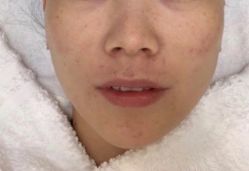 -上海漾颜医疗美容