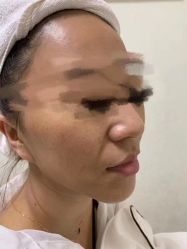 -洁铭新加坡医美