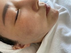 -嘉彼科技美肤中心