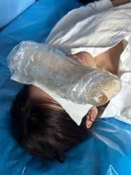 -广州健丽·去眼袋医疗美容机构