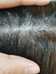 -熙朵美学植发·连锁品牌