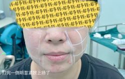 -八大处整形