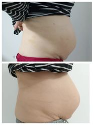 -骄阳兰多产后恢复&减龄中心(万科金域东郡店)