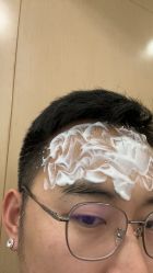 体验前-深圳美莱医疗美容医院