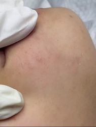 -苗方清颜专业祛痘·皮肤管理