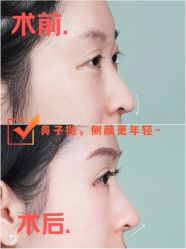 -深圳艺星医疗美容医院