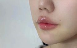 -上海伊莱美医疗美容医院