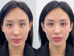 -广州曙光医学美容医院
