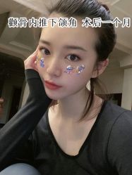 -大麦微针植发全国连锁