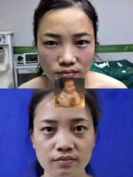 -东莞西妃整形美容医院