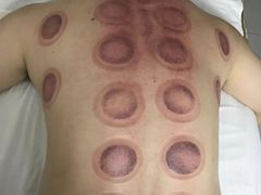 -安琪盲人按摩调理草本熏蒸馆(风和日丽店)