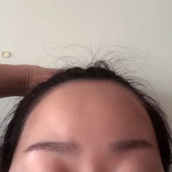 -薇兰专业脱毛连锁机构