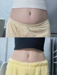 -Lily纤美·科技减脂中心