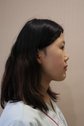 -北京米扬丽格医疗美容·联合丽格鼻整形中心