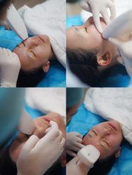 -美壹生诊所皮肤管理中心·海菲秀&Legacy美白舱