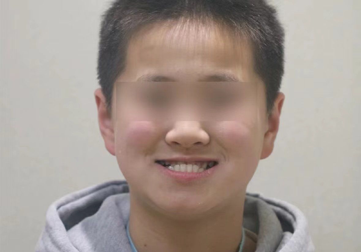 好陷,原来地包天真的要早点干预!