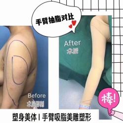 -郡艺医疗美容·微整·眼鼻吸脂