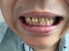 -宁波壹加壹口腔·矫正种植中心