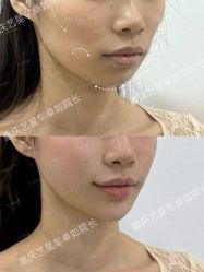-Yestar重庆艺星医疗美容医院
