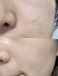 -SKIN79皮肤管理中心