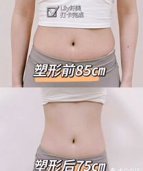 -Lily纤美·科技减脂中心