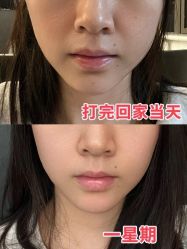 -上海伊莱美医疗美容医院