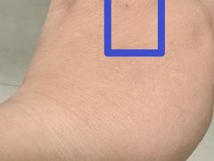 -上海中医药大学附属曙光医院(东部)