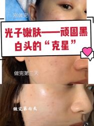 -海峡医疗美容医院