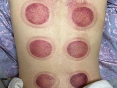 -华集正·专业正骨推拿(集美店)