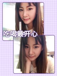 -广东韩妃整形外科医院