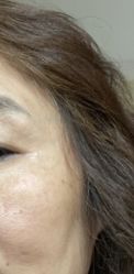 体验后-天津伊美尔医疗整形美容专科医院