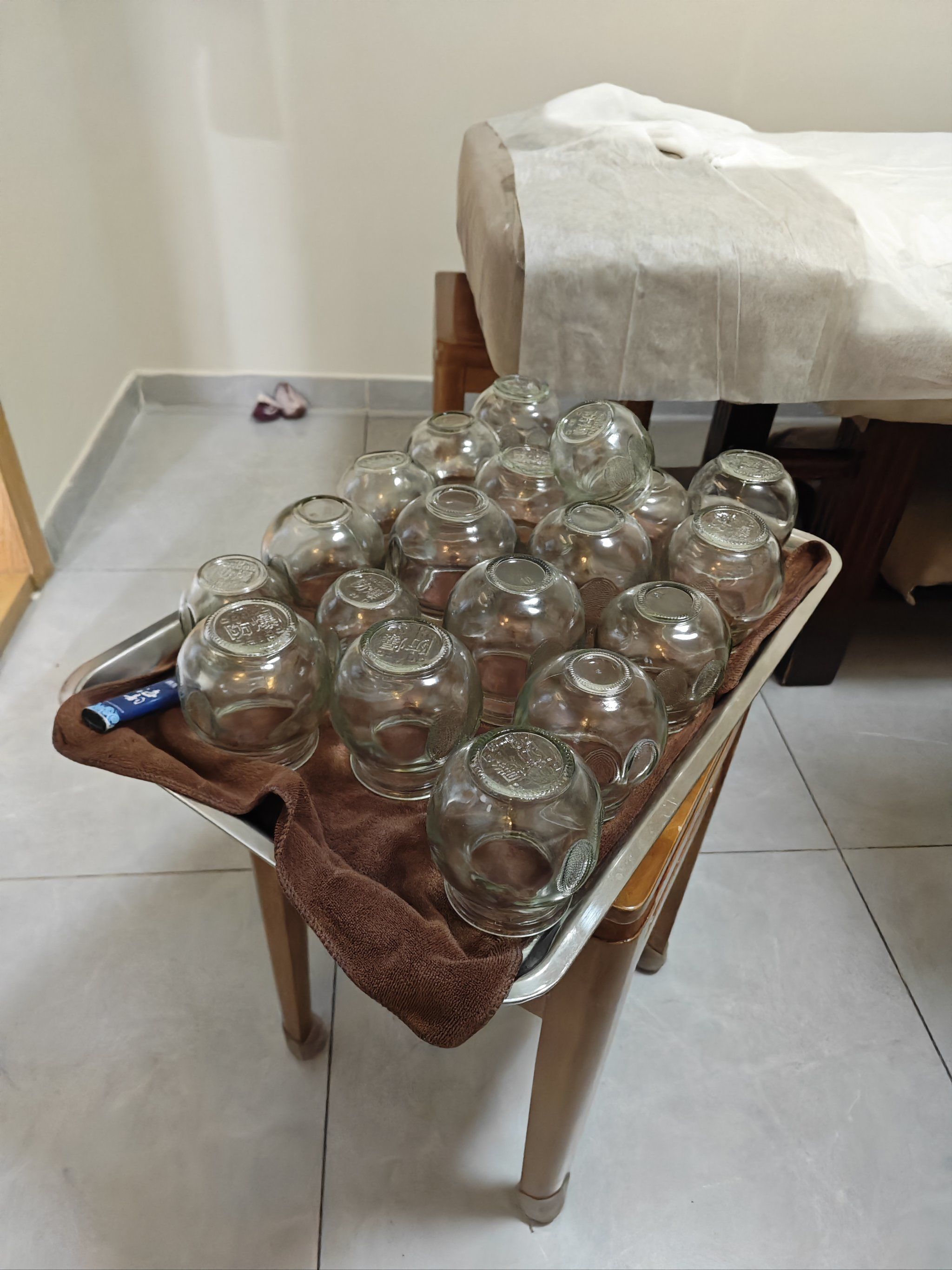 拔罐疗法,中医也能时尚!