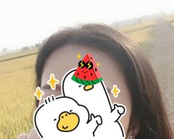 -大麦微针植发全国连锁