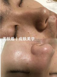 -美肤盾祛痘·问题肌头疗管理中心