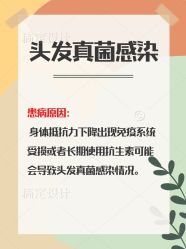 -碧莲盛·不剃发植发