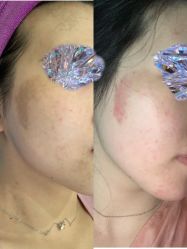 体验前-北京米扬丽格医疗美容·联合丽格鼻整形中心