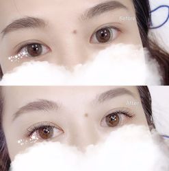 -MOE BEAUTY.皮肤管理中心
