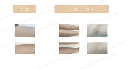 -HEYAN荷妍专业脱毛连锁机构