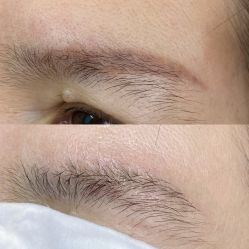 点击看大图 -莱尚·皮肤管理·痘肌护理