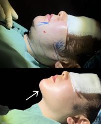 -郡艺医疗美容·微整·眼鼻吸脂