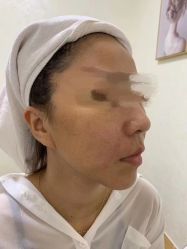 -洁铭新加坡医美