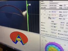 -黑马眼科·近视手术