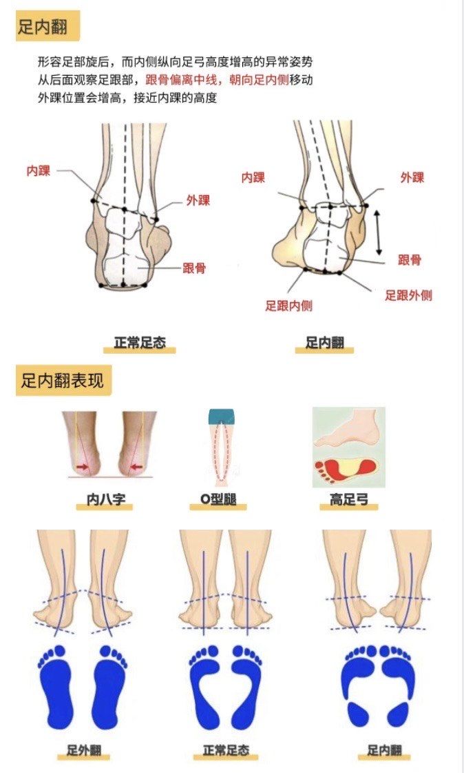 足内翻表现