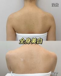-ANNIL安奈尔·NASX超透白·科技抗衰·问题性肌肤管理