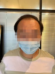 -极客侠男士假发定制补发