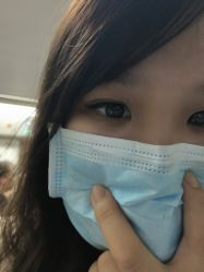 体验后-广州健丽·去眼袋医疗美容机构