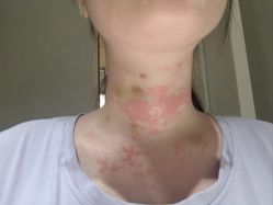 -恒妍医美·韩国定制抗衰中心