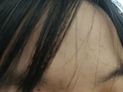 点击看大图 -广州美莱医疗美容医院